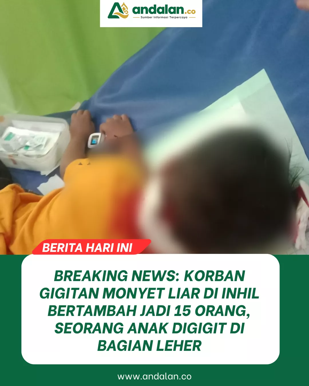 Breaking News: Korban Gigitan Monyet Liar di Inhil Bertambah Jadi 15 Orang, Seorang Anak Digigit di Bagian Leher
