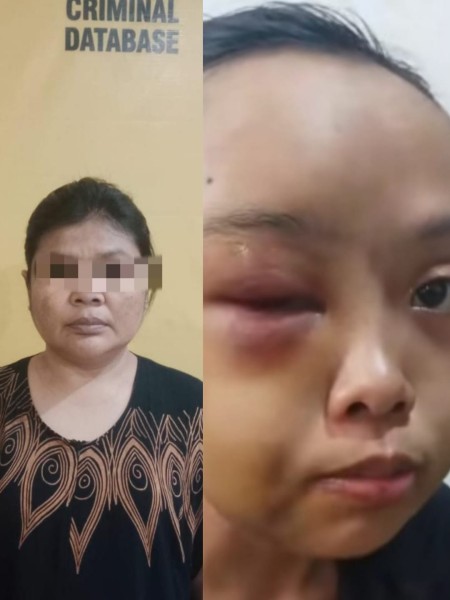 Sadis! Anak Yatim di Tarai Bangun Dianiaya Tante