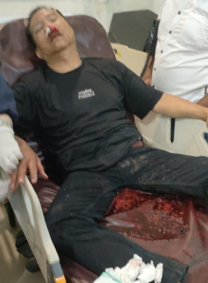 Pengawas KNES Dianiaya Brutal Oleh Kelompok Diduga Preman Bayaran di Tapung Hulu Kampar, Polres Diminta Bertindak