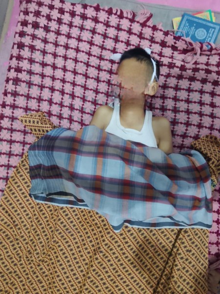 Diduga Dibully Teman, Murid SD di Pekanbaru Meninggal Dunia