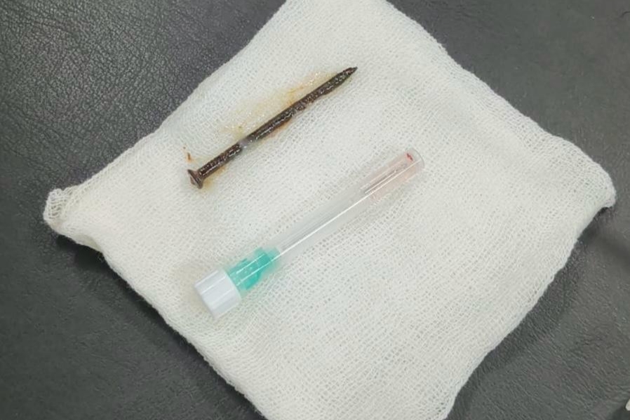 Tanpa Operasi, RSUD Arifin Achmad Sukses Angkat Paku 5 cm dari Paru-paru Pasien