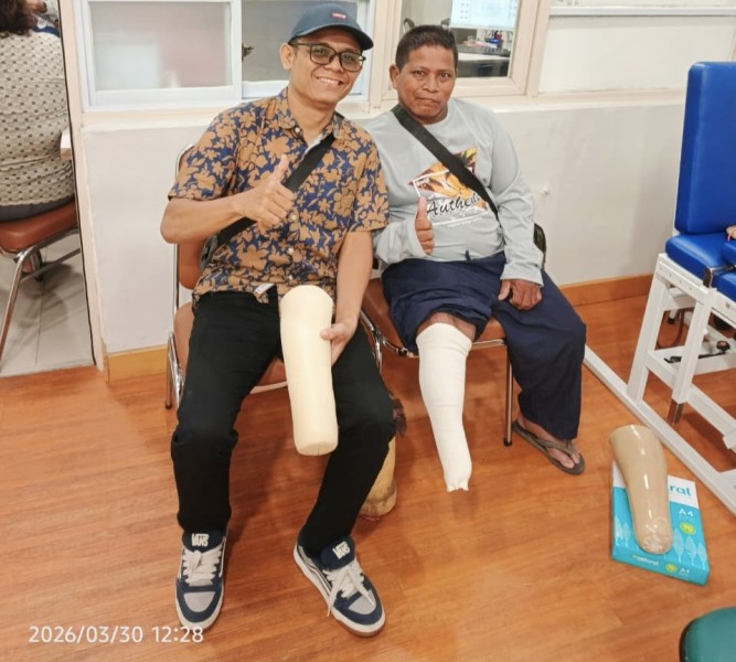 Tinggalkan Kaki Kayu Rakitan Sendiri, Pak Ponidi Asal Rohil Segera Miliki Kaki Palsu Medis dari KSJ Riau