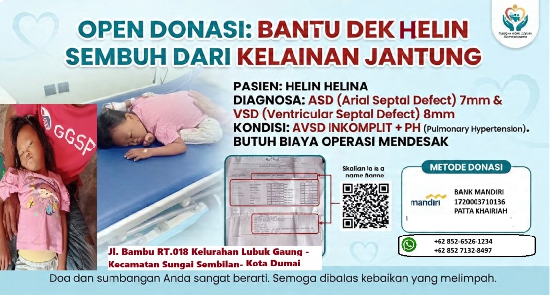 Perjuangan Panjang Helin Melawan Kelainan Jantung, Keluarga Berharap Uluran Tangan untuk Berobat ke Jakarta