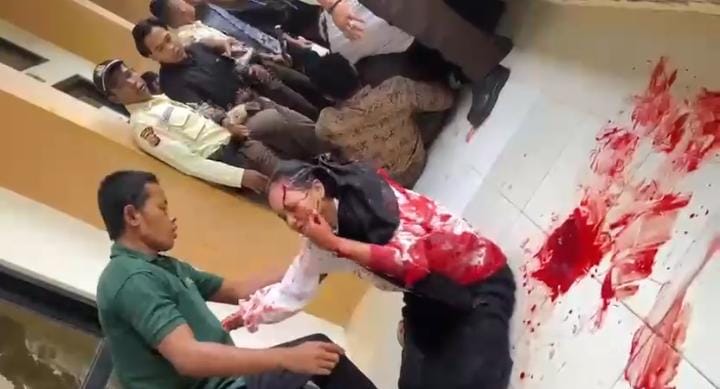 Mahasiswi UIN Suska Dibacok Saat Hendak Seminar, Diduga Dipicu Persoalan Asmara