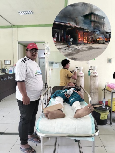 Pedagang Minyak di Tembilahan Alami Luka Bakar, Biaya Perawatan Ditanggung BPJS Ketenagakerjaan