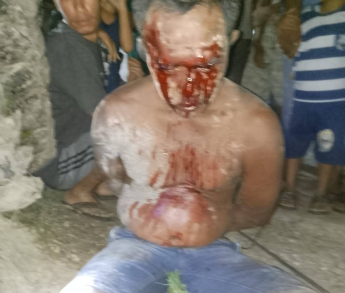 Biadab! Ayah di Rokan Hulu Tega Perkosa Dua Putri Kandung, Jadi Bulan-bulanan Massa Hingga Babak Belur