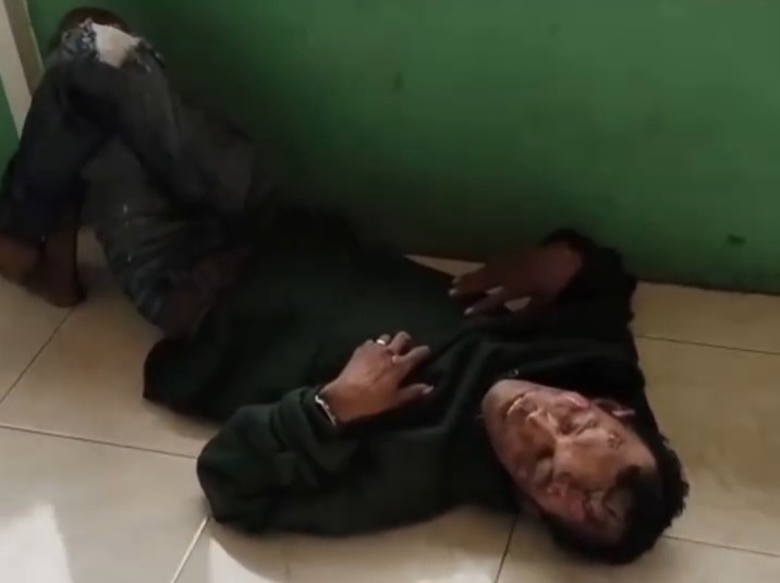 Mister X Ditemukan Terbaring Lemah di Teras Masjid Minas Barat, Diduga Korban Kecelakaan