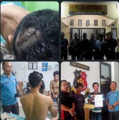 LSM Penjara Siak Kecam Dugaan Penganiayaan Brutal oleh Satpam PT KTU Astra, Minta Polres Siak Bertindak Tegas