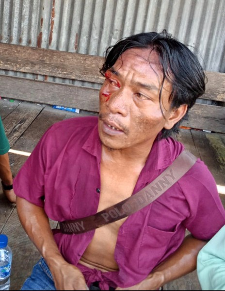 Hampir Sebulan Nihil Tersangka, Kasus Pengeroyokan Syafrijal di Dumai Tuai Sorotan: Hukum Hanya untuk Orang Berduit?