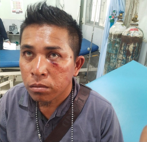 Meliput BBM Ilegal di Kandis, Wartawan Okegas.co.id Babak Belur Dikeroyok