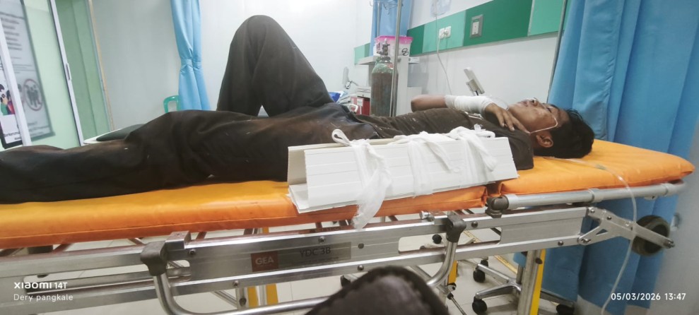 Kecelakaan Kerja di PT IMT Dumai, Tangan Pekerja Alih Daya Tergilas Konveyor