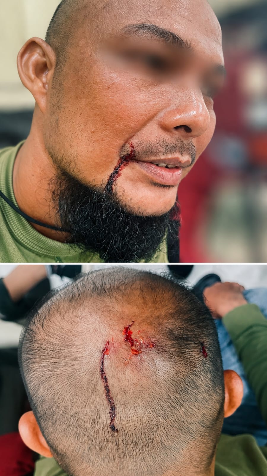 Petugas Pemungut Pajak Parkir di Dumai Diduga Dikeroyok, Dipukul dan Dihantam Helm hingga Berdarah
