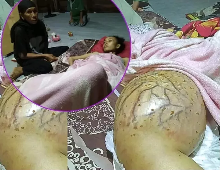 Nurhafiza, Warga Tanjung Pasir, Butuh Bantuan Biaya Pengobatan