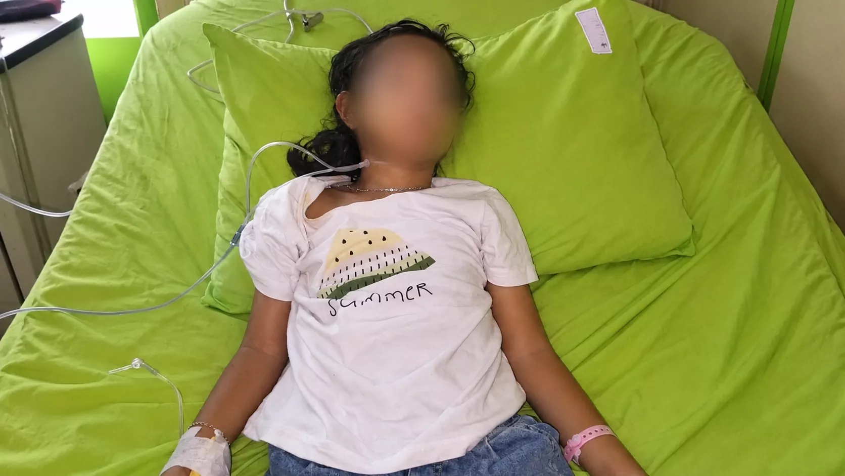 Sempat Sesak Napas, Anak 7 Tahun di Palembang Meninggal Mendadak di Tengah Kabut Asap