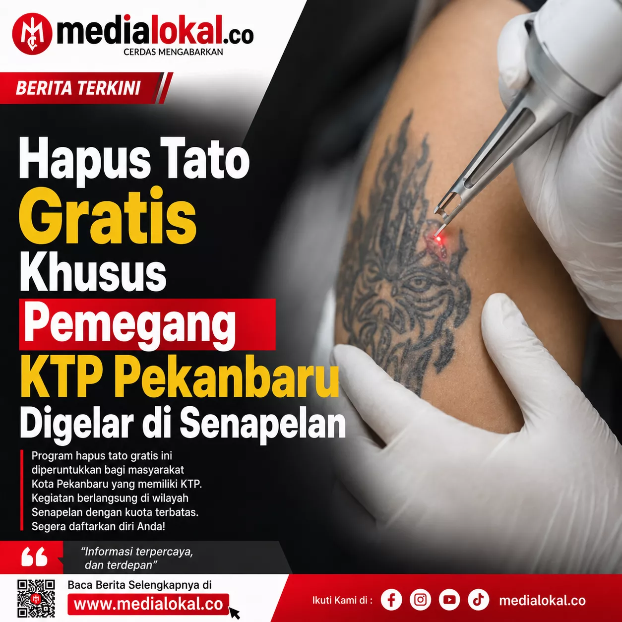 IPP dan Elang 3 Hambalang Buka Layanan Hapus Tato Gratis di Senapelan Pekanbaru