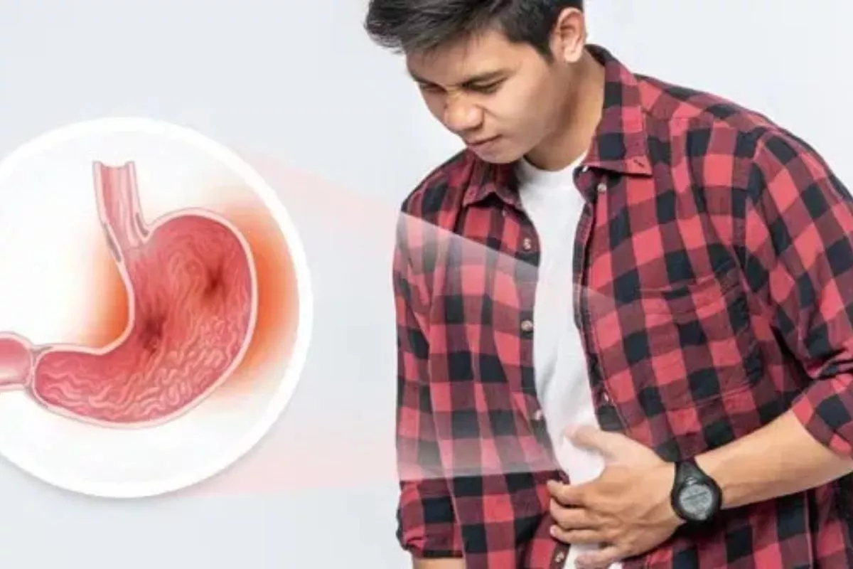 Kenali Penyebab Maag, Gejala, dan Cara Ampuh Mencegahnya 