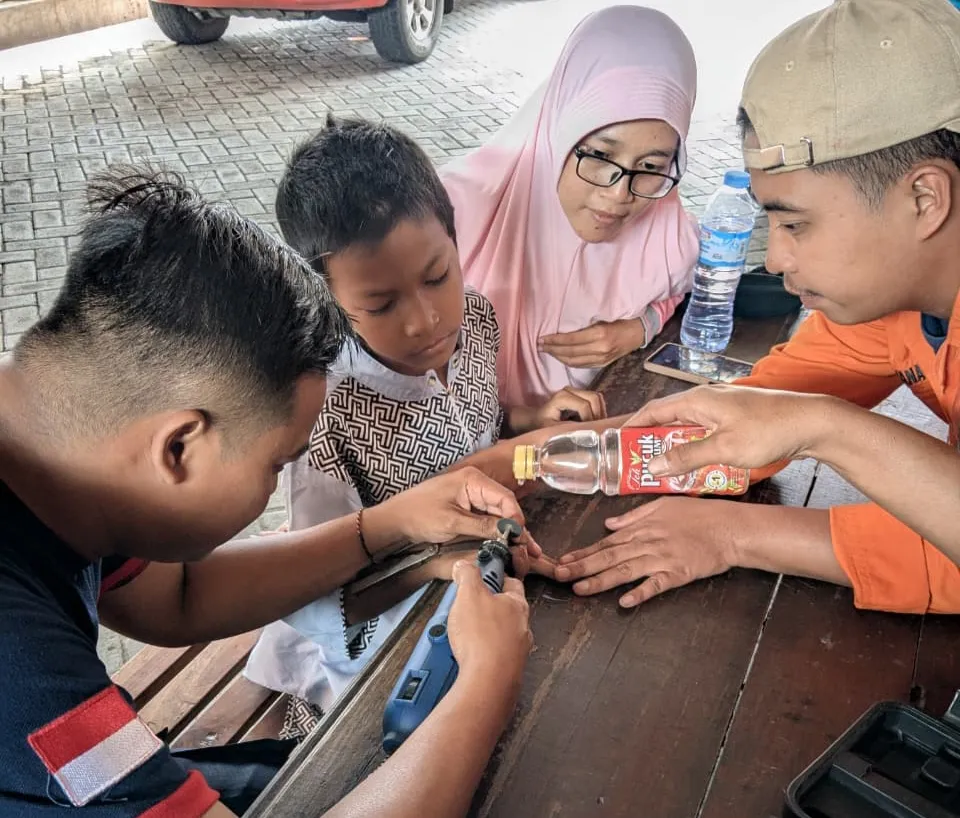 Jari Membengkak, Bocah 9 Tahun di Pasuruan Datangi Markas BPBD untuk Lepas Cincin