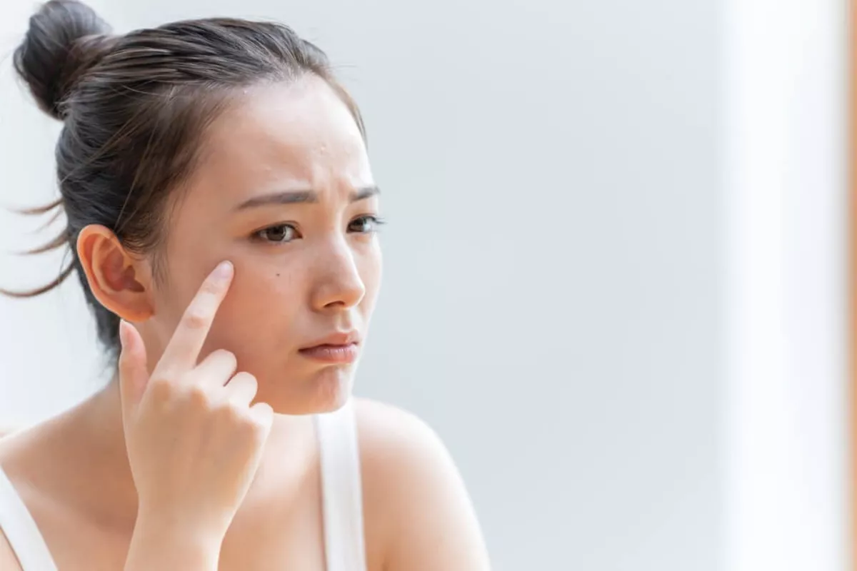 Panduan Layering Bahan Aktif untuk Kulit Berjerawat Aman