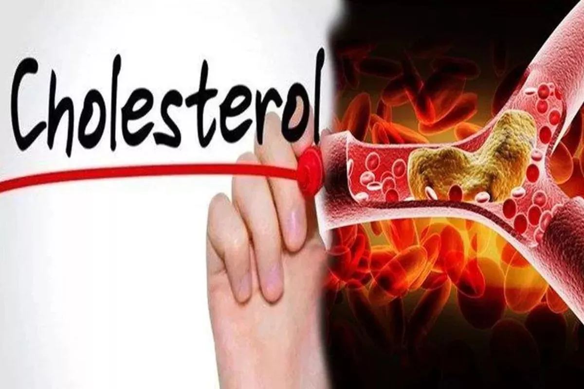 Waspada Kolesterol Tinggi: Kenali 9 Pemicu Utamanya di Sini