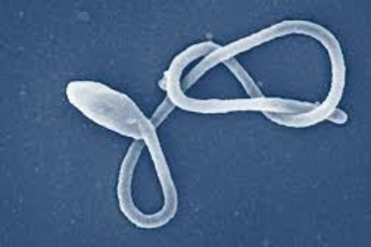 Kilas Humaniora: Mitigasi Kekerasan hingga Update Ebola