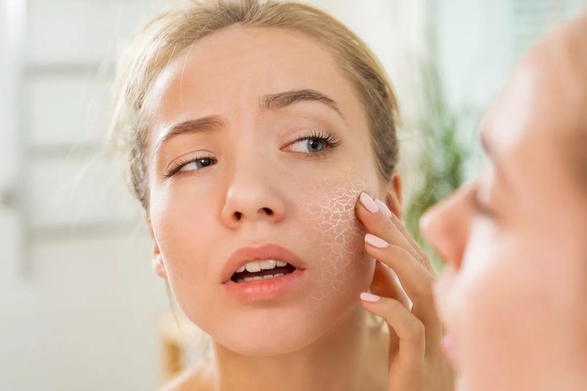 Penyebab Kulit Kering Walau Rutin Pakai Skincare: Kurang Tidur