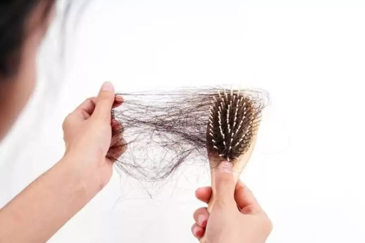 Tips Dokter Bedah Kenali Rambut Rontok yang Butuh Perawatan