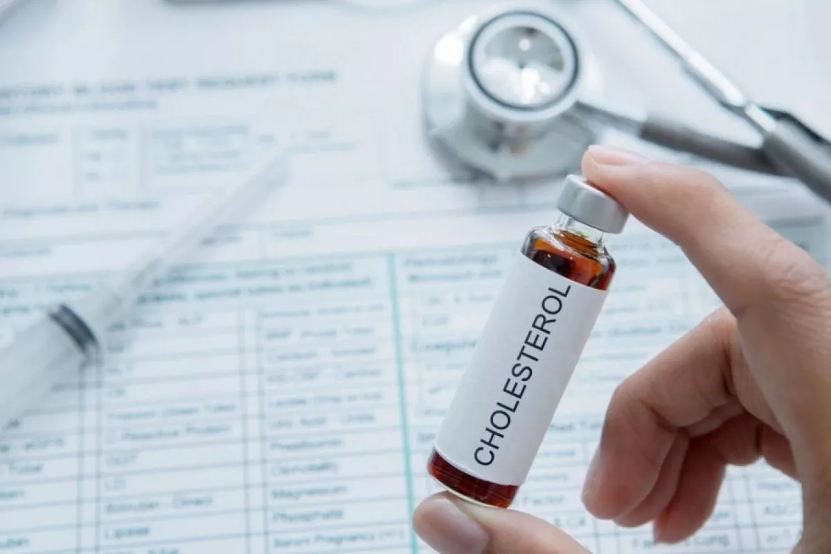 Cegah Stroke dan Jantung, Dokter Ingatkan Rutin Cek Kolesterol