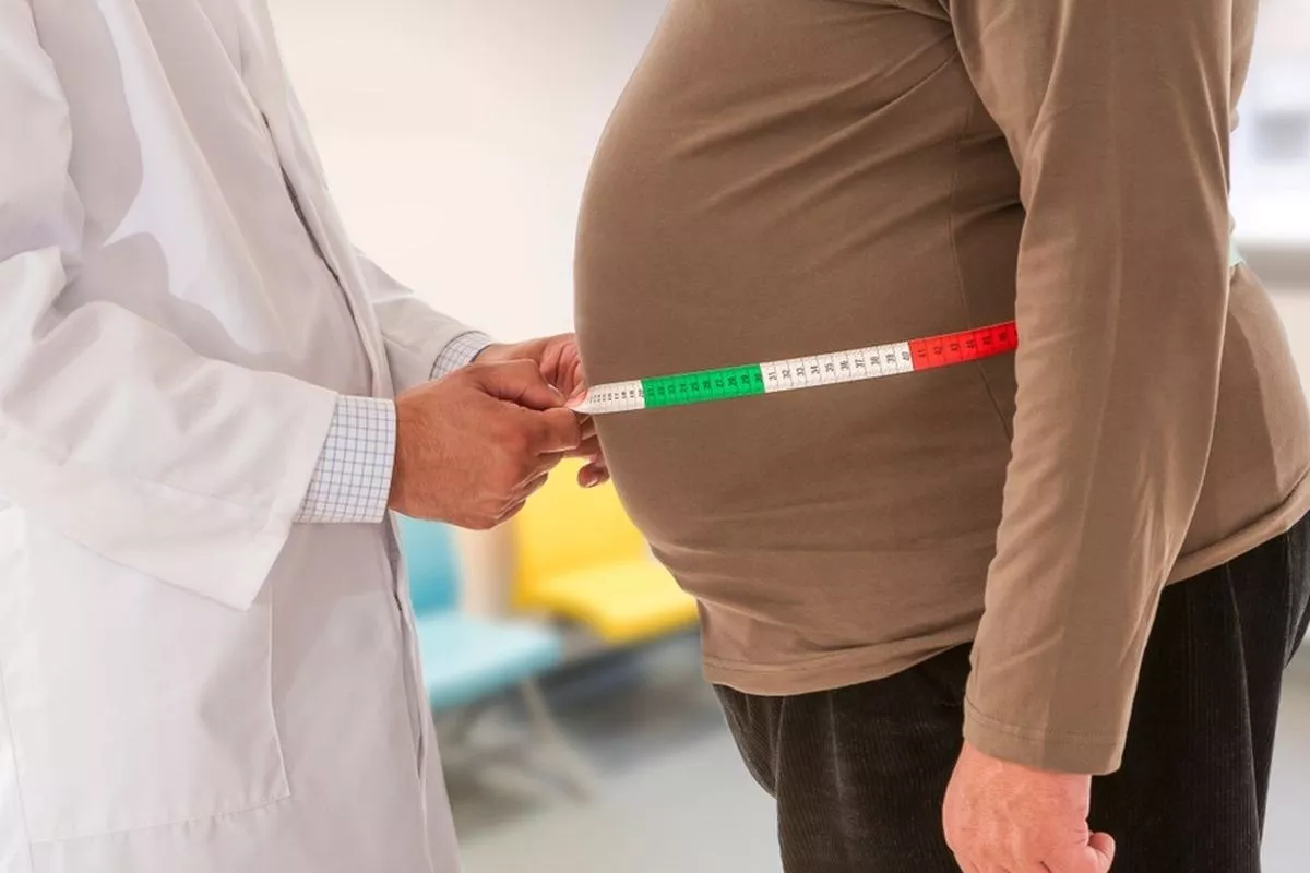 Bukan Genetik, Pola Hidup Jadi Faktor Utama Obesitas