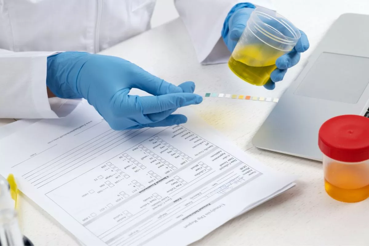 Cegah Narkoba, Lapas Perempuan Malang Gelar Tes Urine Acak