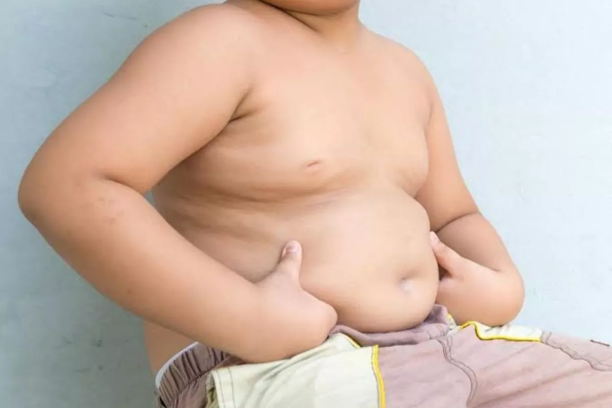 Waspada Obesitas pada Anak Bisa Picu Gangguan Mata Astigmatisme