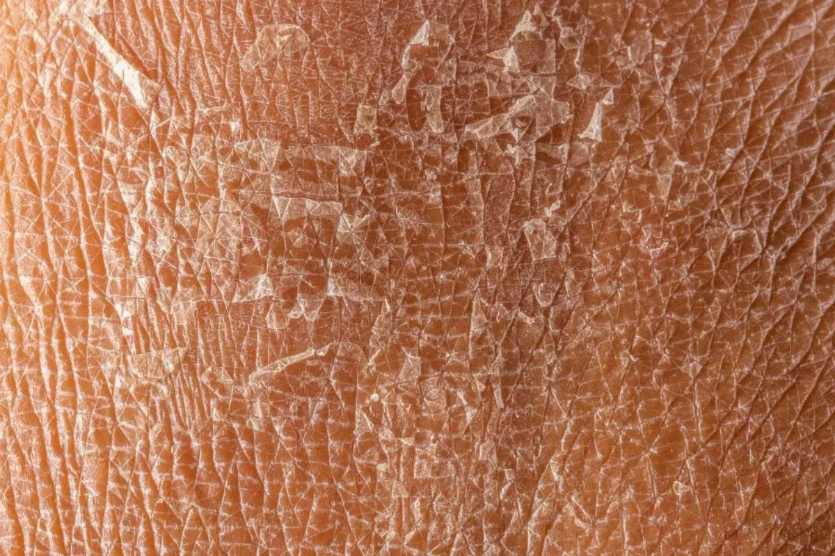 Kulit Kasar Bersisik? Ini Kebiasaan Mandi yang Membuat Kulit Semakin Kering