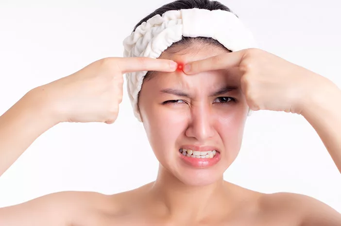Cara Menghilangkan Jerawat: Analisis Kebiasaan Sehari-hari Memicu Akne