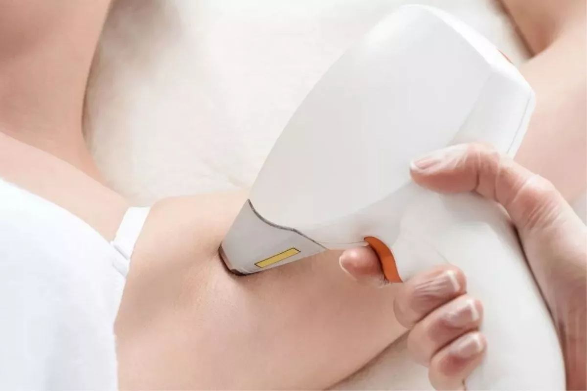 Pilih Laser atau Waxing? Kenali Perbedaan dan Efektivitasnya
