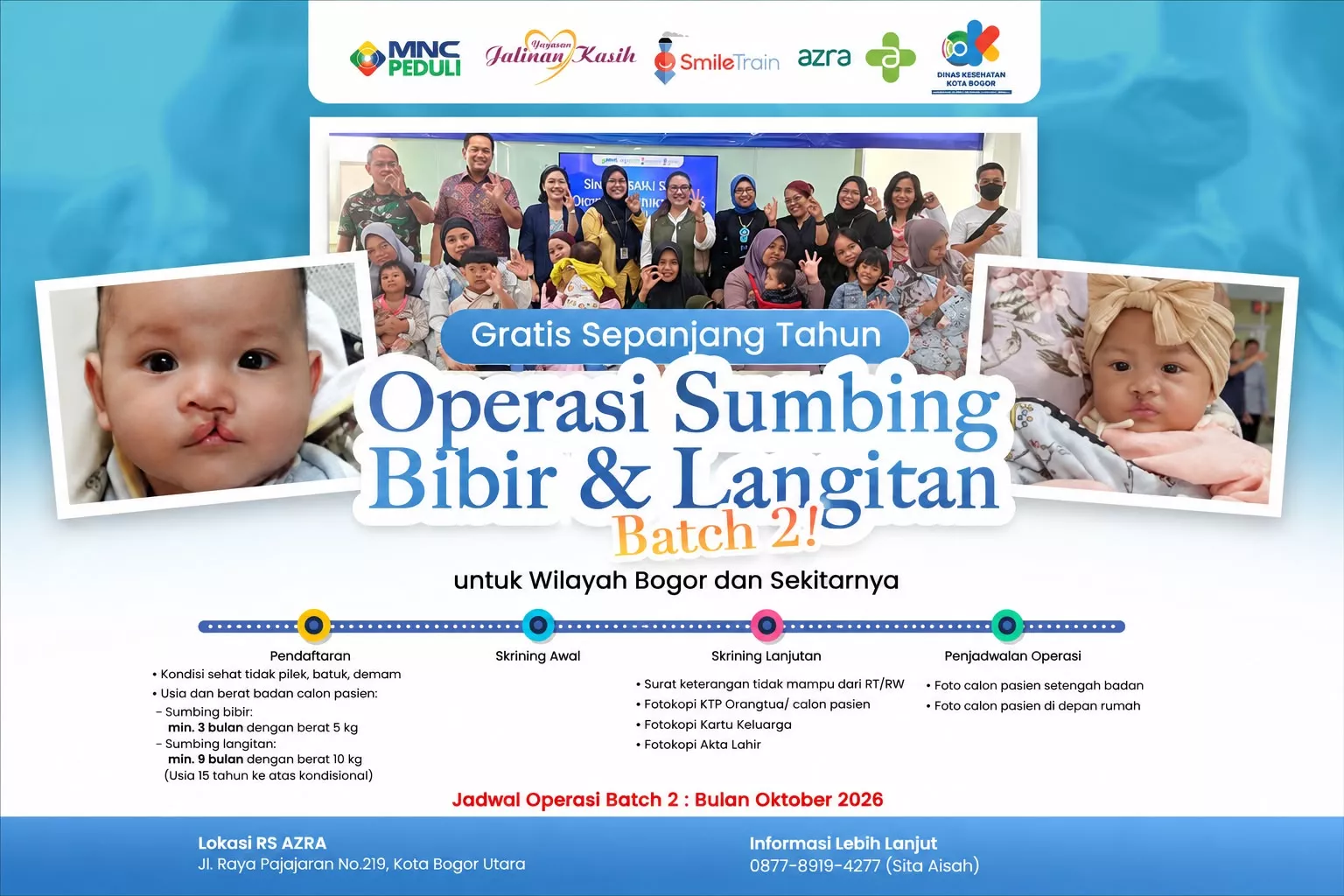 RS Azra Hadirkan Operasi Gratis Bibir Sumbing dan Langitan Batch 2 di Bogor 2026