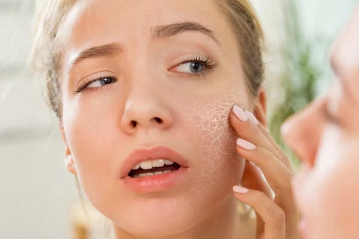 Panduan Lengkap Tips Skincare Pemula Kulit Kering