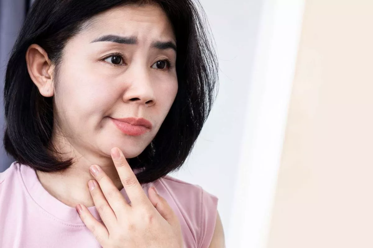 Mengenal Gejala Bell's Palsy pada Wajah dan Cara Mengatasinya