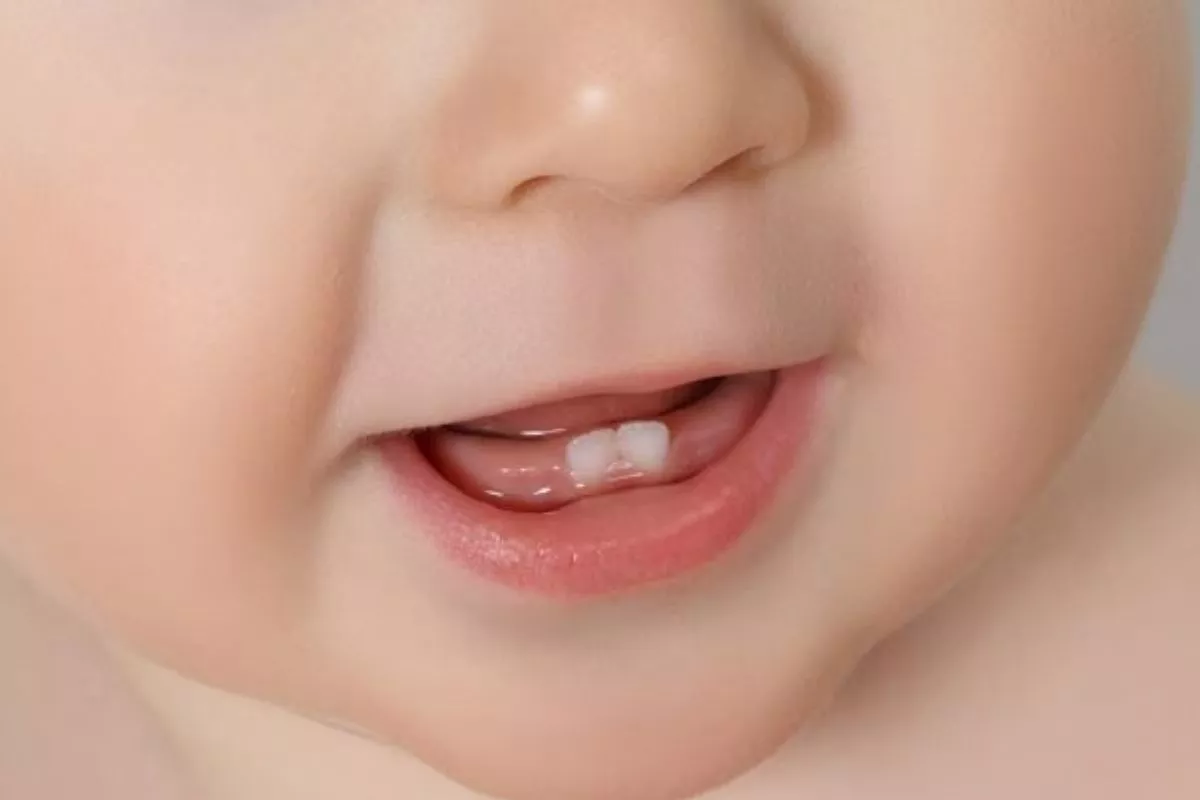 Penyebab Bayi Belum Tumbuh Gigi Usia 1 Tahun dan Kapan Harus Berobat