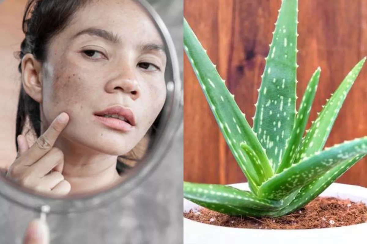 5 Manfaat Lidah Buaya untuk Flek Hitam Menahun dan Cara Pakai yang Benar