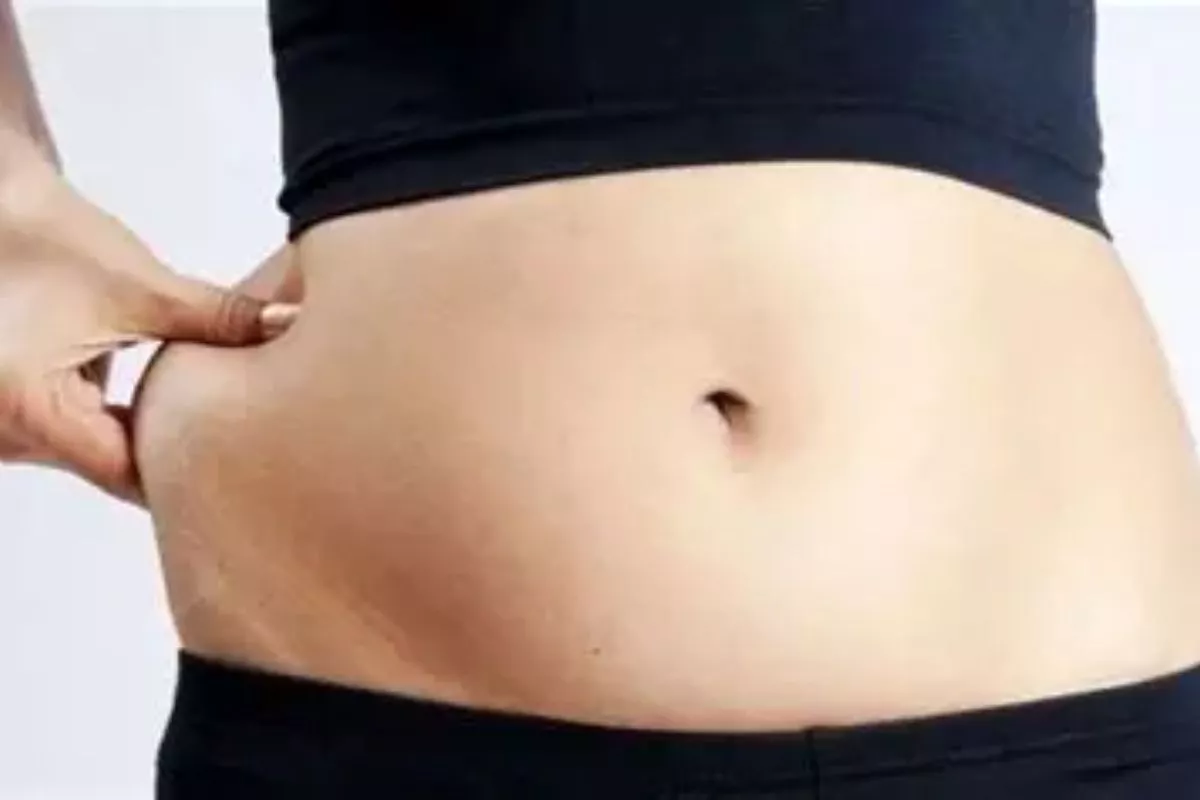 Viral, Perut Membuncit Wanita Muda di Bekasi Ternyata Kista 29 Cm