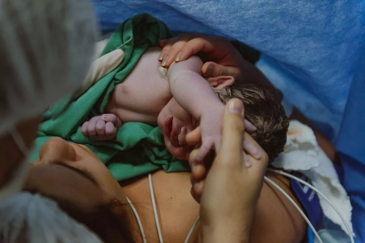 Peran ASI Dan Kolostrum Dalam Memperbaiki Mikrobiota Usus Bayi Caesar
