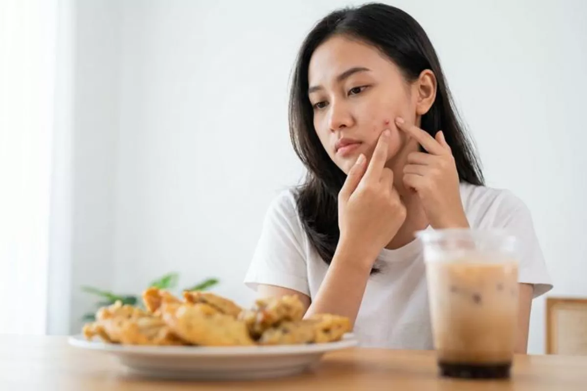 Hubungan Diet Makanan dengan Jerawat yang Harus Diketahui
