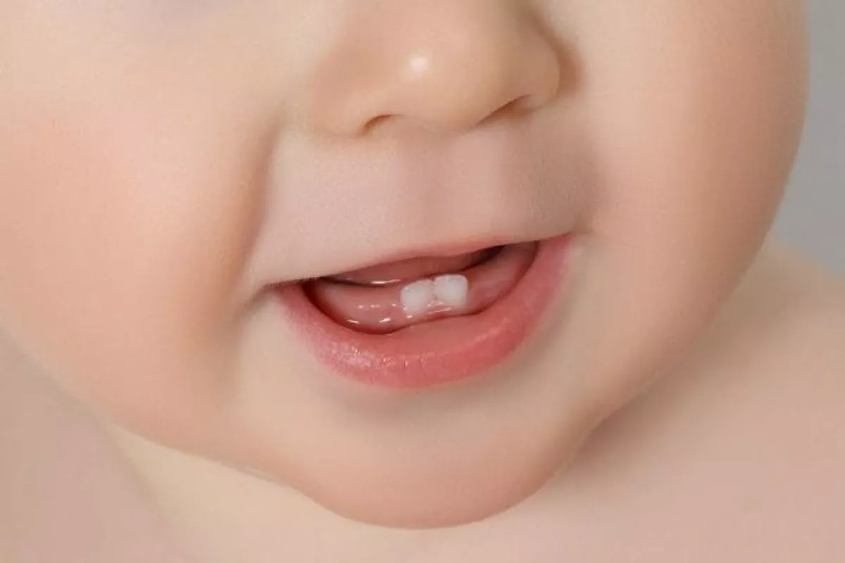 Ketahui Rentang Usia Tumbuh Gigi Bayi Beserta Waktu Tepat Periksa