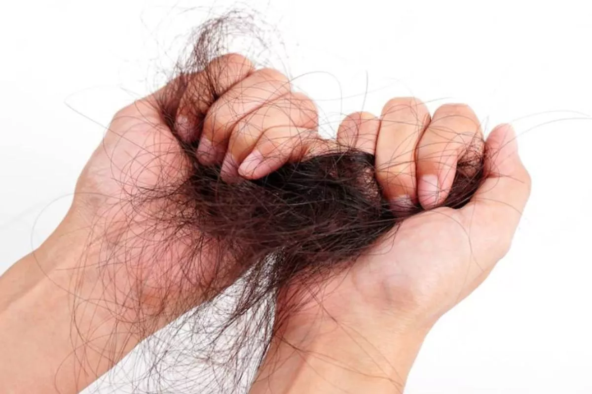 Penyebab Rambut Rontok Berlebih pada Wanita Hijab dan Cara Mencegahnya