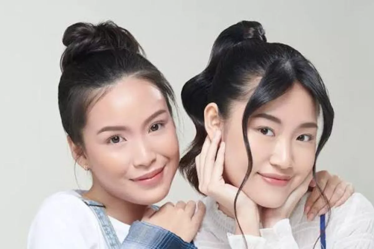 Smile Lines Muncul Lebih Cepat? Ini Penyebab dan Cara Mengatasinya