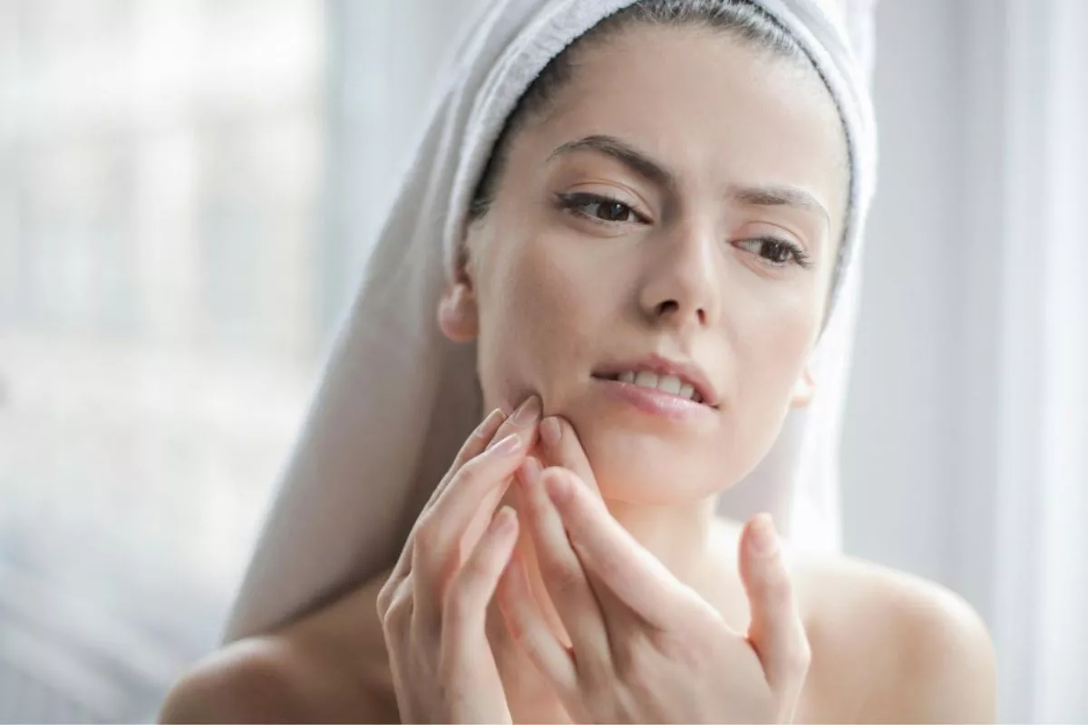 Wajah Hancur karena Skincare? Ini Cara Melakukan Patch Test Alami!