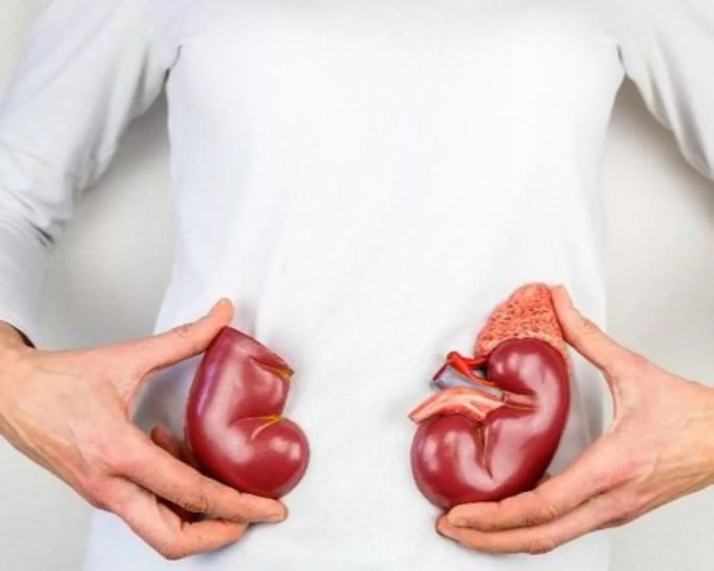 Cara Alami Menjaga Kesehatan Ginjal Melalui Pola Makan Sehat