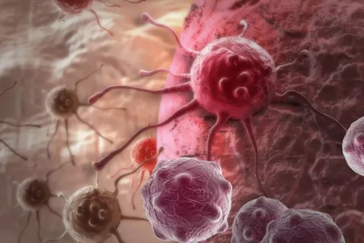 Studi Terbaru Sebut Penuaan Biologis Jadi Pemicu Kanker Usia Muda