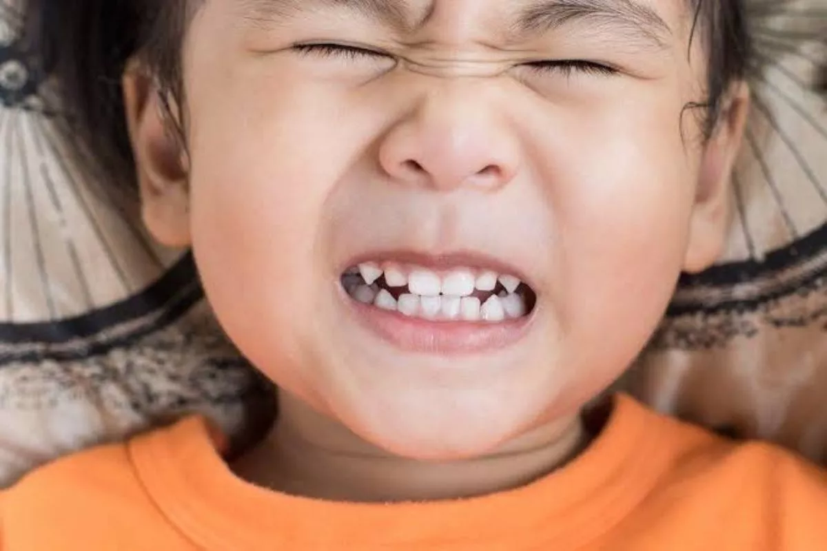 Dampak Buruk Kerusakan Gigi pada Stabilitas Mental Anak