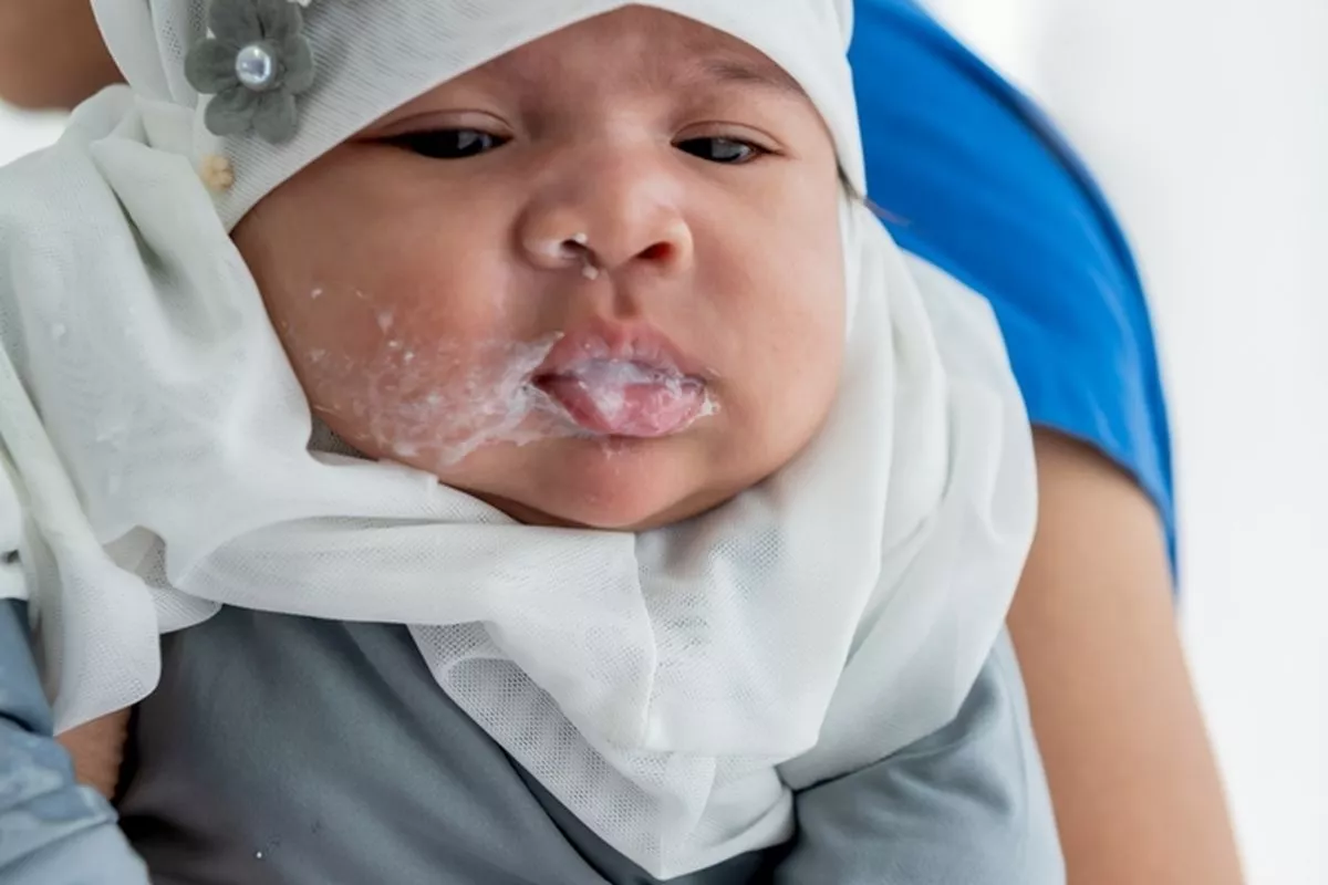 Orang Tua Jangan Panik karena Mayoritas Bayi Gumoh adalah Normal