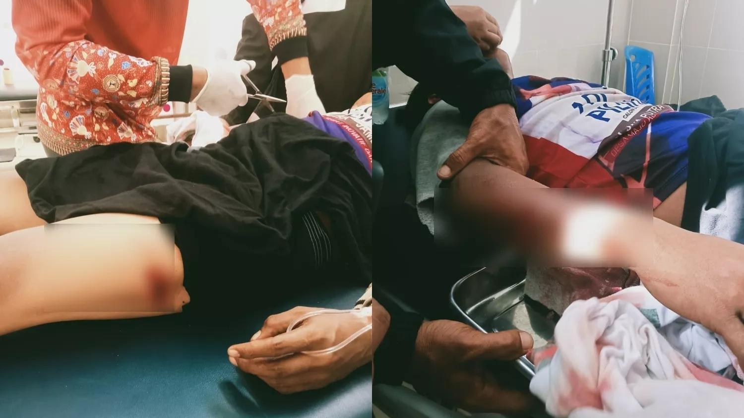 Pengeroyokan di Area PT Marketindo Selaras, Satu Karyawan Alami Luka Parah